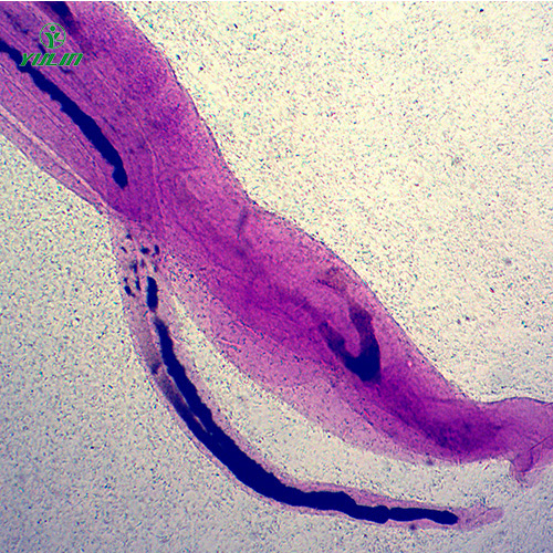 广东日本血吸虫雌雄合抱装片