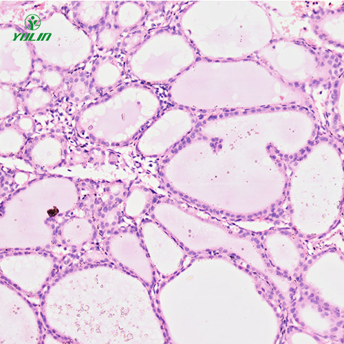 广东人内分泌系统疾病标本片