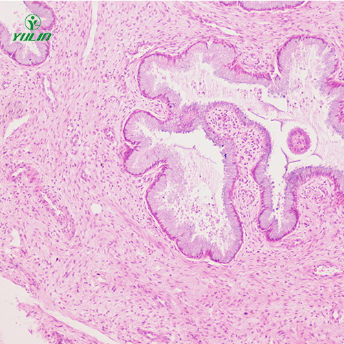 广东人泌尿生殖系统疾病标本片