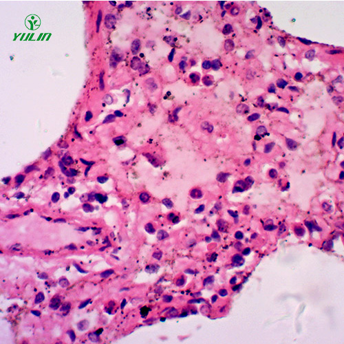 广东人呼吸系统疾病标本片