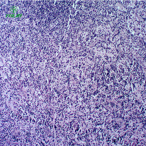 广东人体免疫性疾病切片