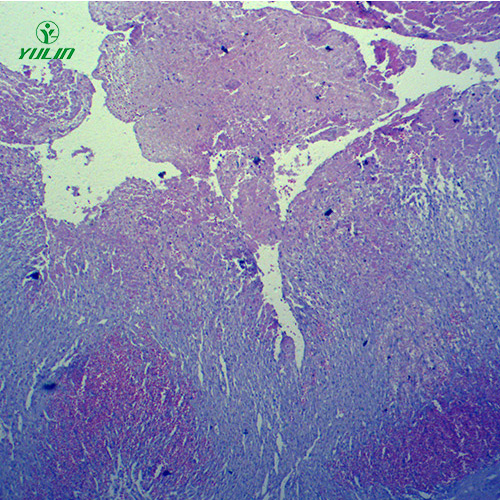 广东人体局部血液循环障碍病理玻片