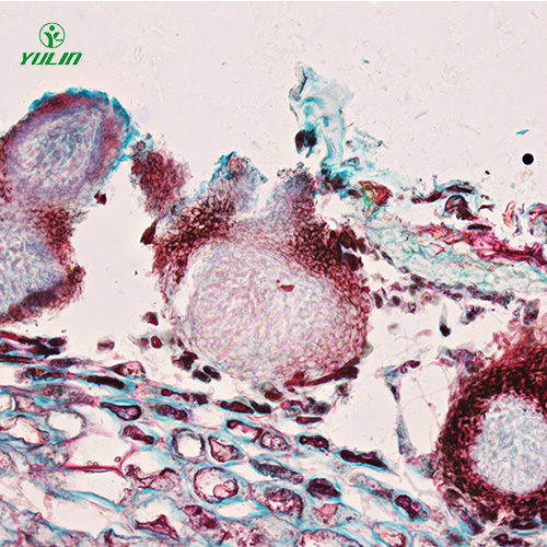 广东水果病害标本片