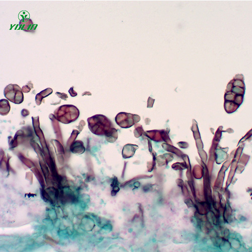 广东茄科植物病害玻片