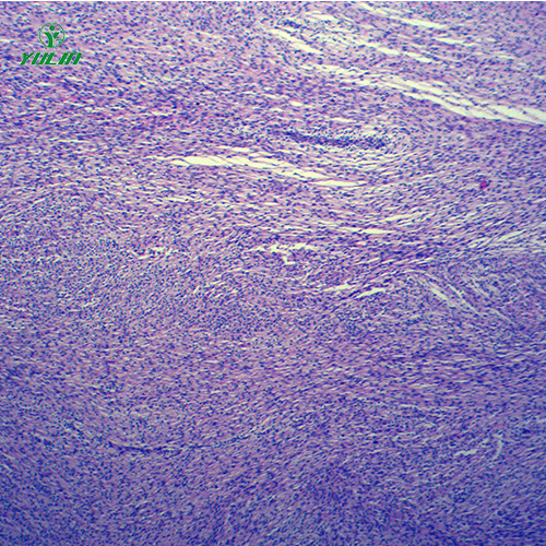 广东人体肿瘤病理玻片