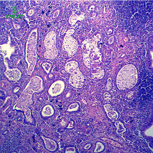 广东炎症病理玻片